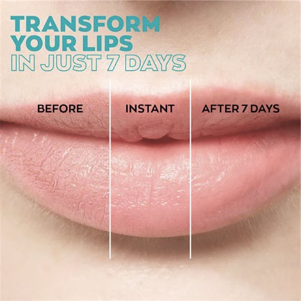 Avon Anew Revival Lip Treatment