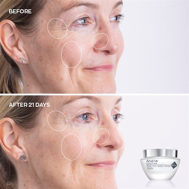 Avon Anew Sensitive+ Dual Collagen Collection