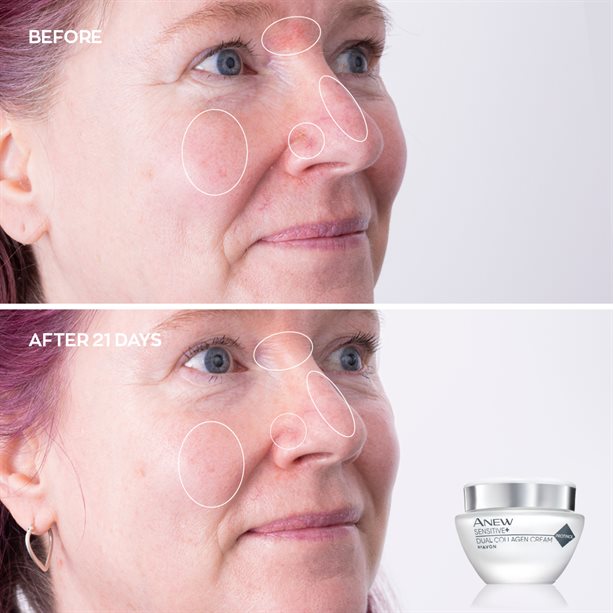 Avon Anew Sensitive+ Dual Collagen Collection